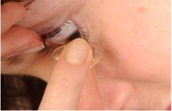 Person looking downwards while removing a contact lens