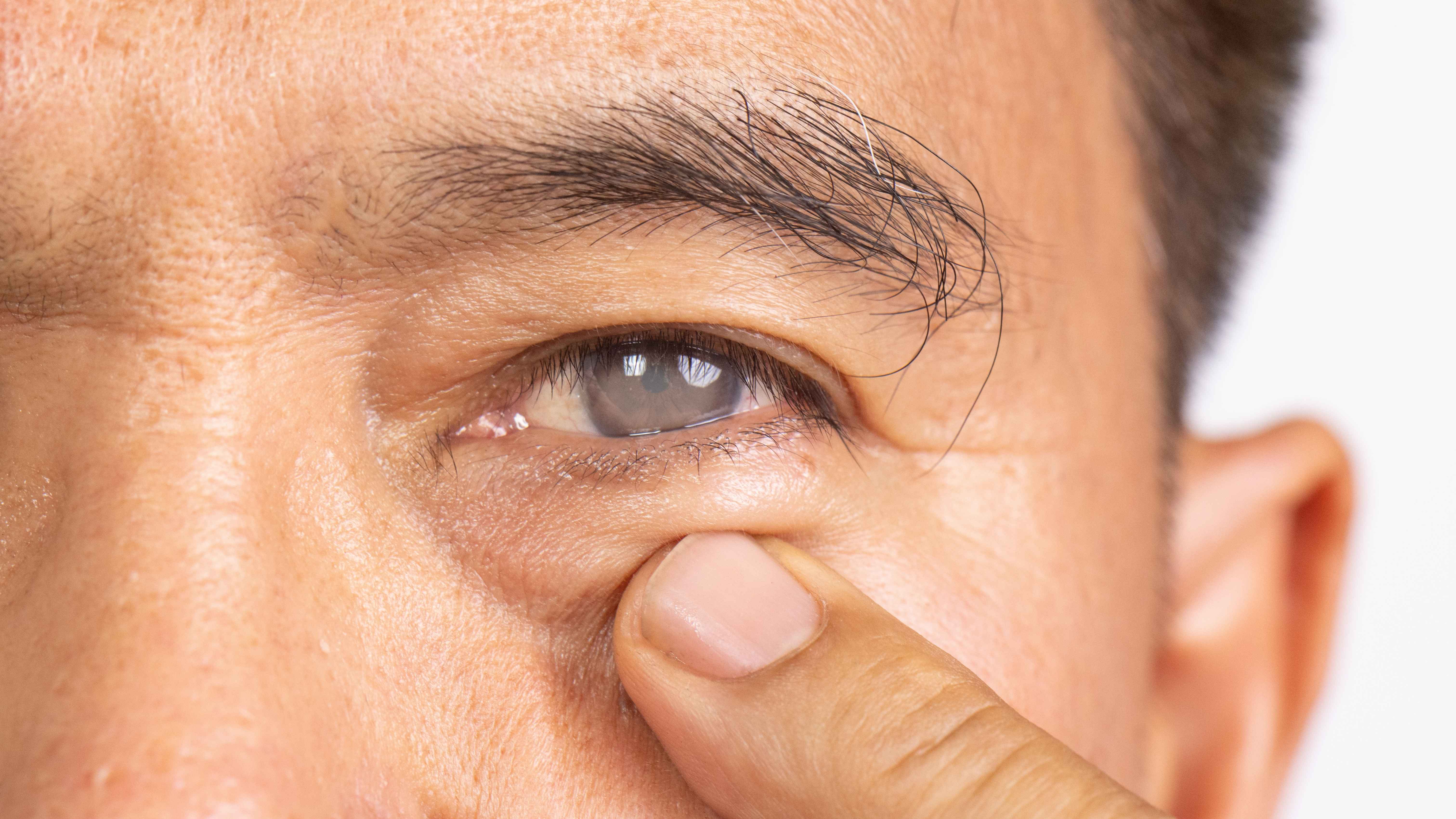 Eye oncology cover image